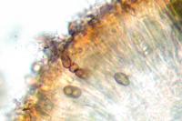 Hyperphyscia adglutinata