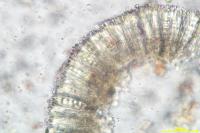 Lecidella elaeochroma