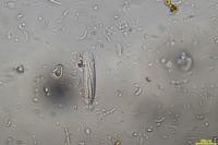 Opegrapha vulgata